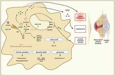 Metabolic changes in fibroblast-like synoviocytes in rheumatoid arthritis: state of the art review